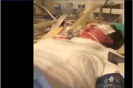 فيديو وثق أنفاسها الأخيرة داخل العناية المركزة.. ملاك تبكي العراق