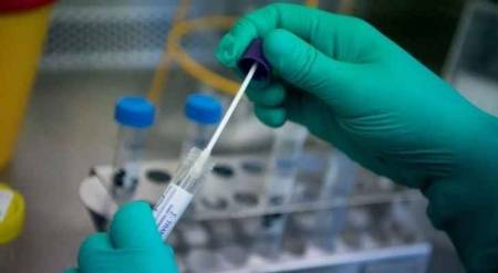 مستشار أمراض جرثومية أوقفوا الفحوص العشوائية ووفروا الأموال