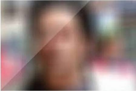 تسريب صورة لفنان شهير بدون باروكة رأسه.. شاهد كيف يبدو شكله