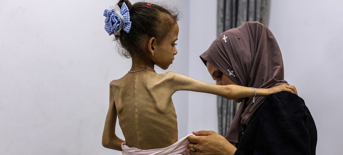 165 يوما لعودة الحرب.. عشرات الشهداء والجرحى وحالات وفاة جوعا