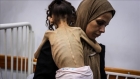 دعما لغزة.. إضراب عالمي عن الطعام في 100 مدينة عربية ودولية